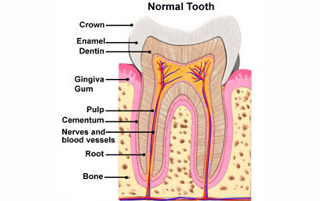 best root canal treatment in gurgaon