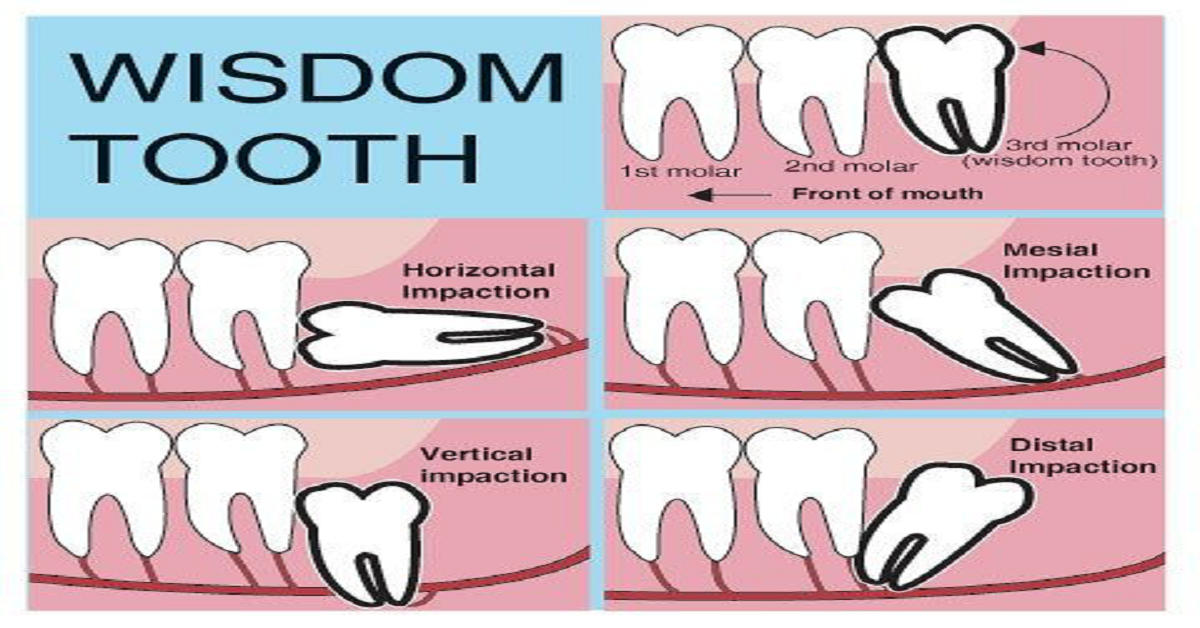 blog-dental-homes-1-1200x628.png